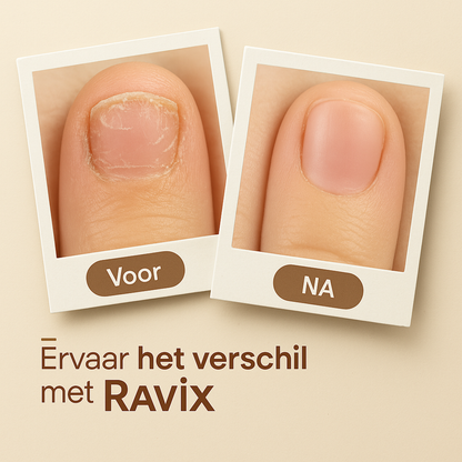 Ravix™ Elektrische Baby Nagelvijl (Roze)